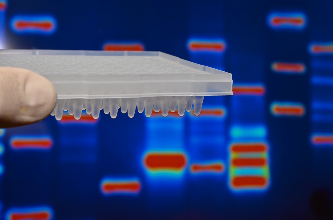 Alport mutations