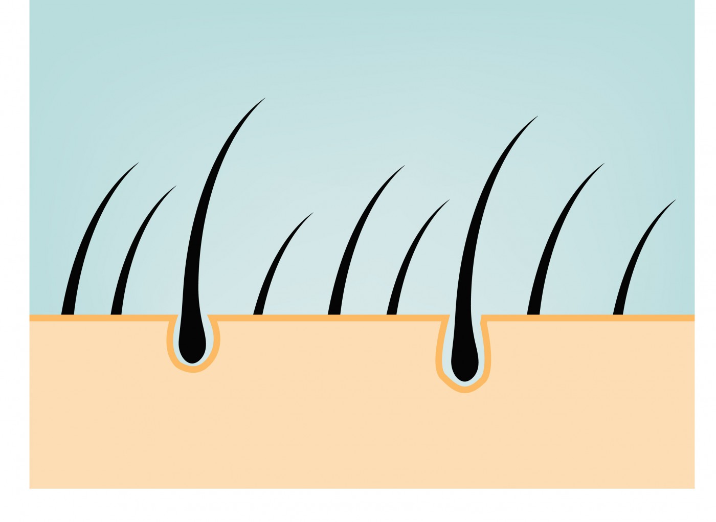 Gene Variant Leading to Alport Syndrome