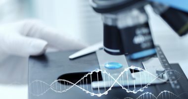 XLAS, COL4A3 or COL4A4 mutations