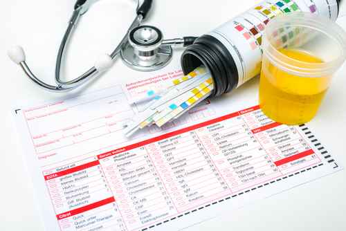 EGF urine progression