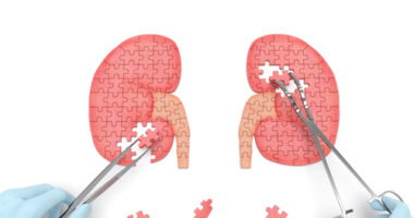 kidney health in US